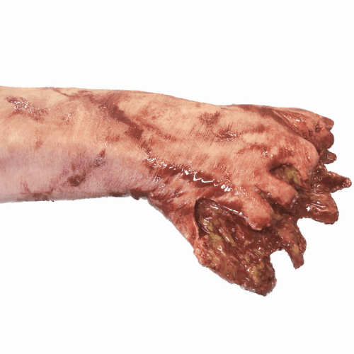 Simulera arm med sårskada